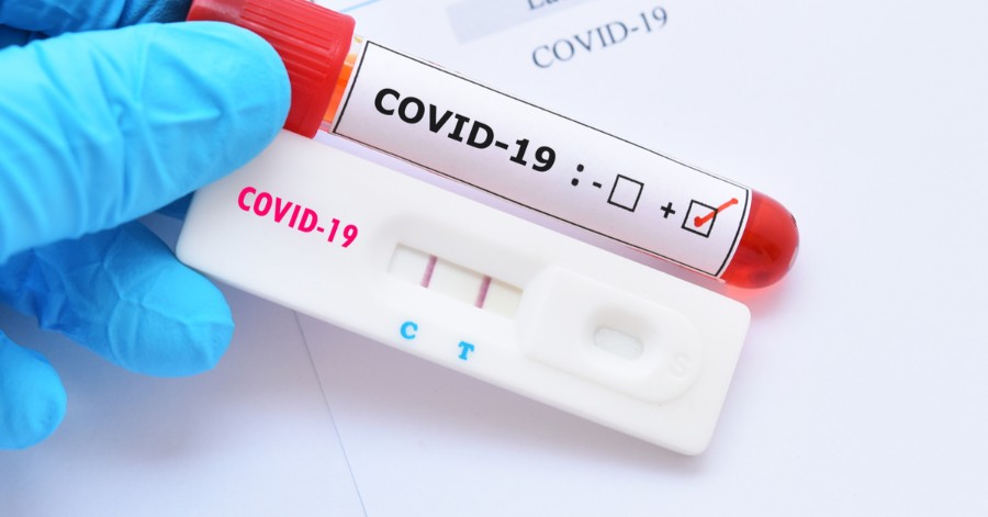 Novo Horizonte do Sul - Primeiro caso de covid 19 é confirmado