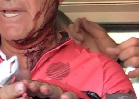Ex-piloto da Moto GP leva tiros na cabeça e sobrevive; atleta mostra a cicatriz em rede social