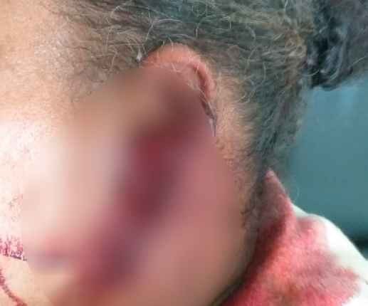 Mulher é agredida depois de flagrar esposa aos beijos com adolescente de 13 anos