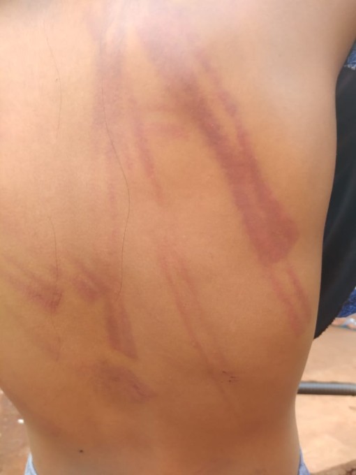 Filha é espancada pelo pai com mangueira em Nova Alvorada do Sul