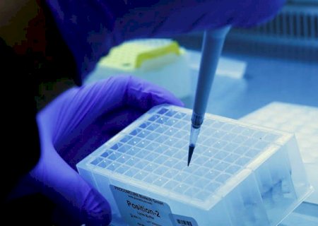 Brasil tem 15 pesquisas de vacina contra covid em andamento