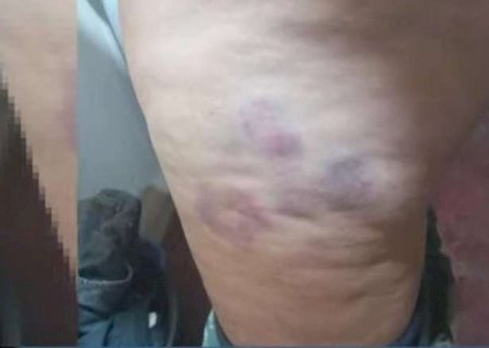 Mulher foge depois de passar três dias sendo espancada e estuprada em cárcere privado