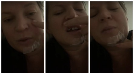 Joice Hasselmann sofreu queda e não houve agressão, diz polícia