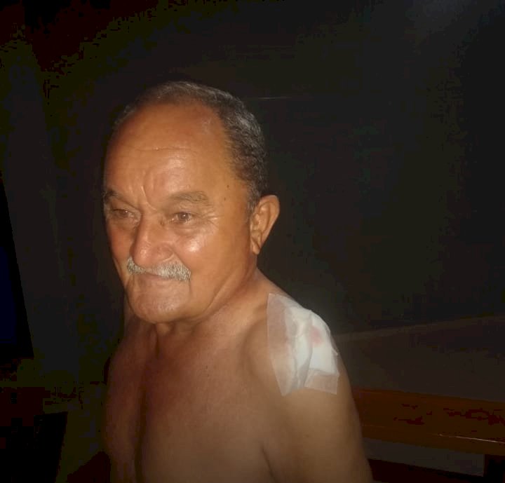 Batayporã: Baixinho da sabão é atacado por pitbull