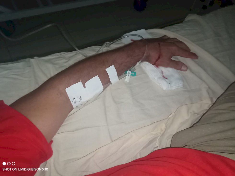 Ivinhema - Bombeiro sofre ferimento ao capturar um tamanduá de grande porte.