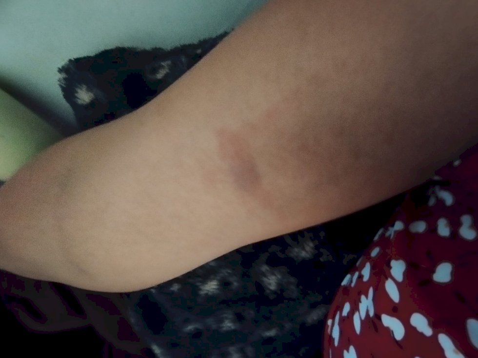 Ivinhema - Vereadora relata nas redes sociais a agressão sofrida pelo irmão.
