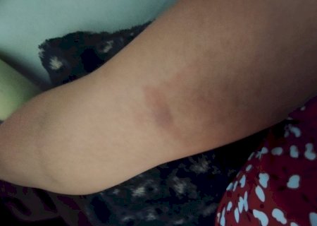 Ivinhema - Vereadora relata nas redes sociais a agressão sofrida pelo irmão.