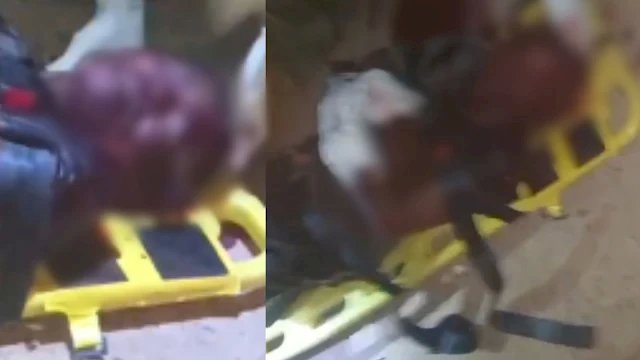 Homem fica em estado grave após receber vários golpes de faca e quase ter punho arrancado