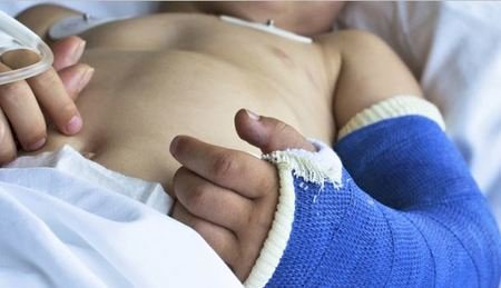 Mãe é acusada de maus-tratos a bebê de seis meses internado com fratura no braço