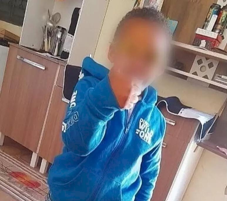 Criança morre após explosão com álcool enquanto a tia queimava carrapatos de cachorro
