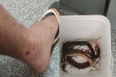 Homem é picado por jararaca e chega para ser atendido com cobra dentro de um balde