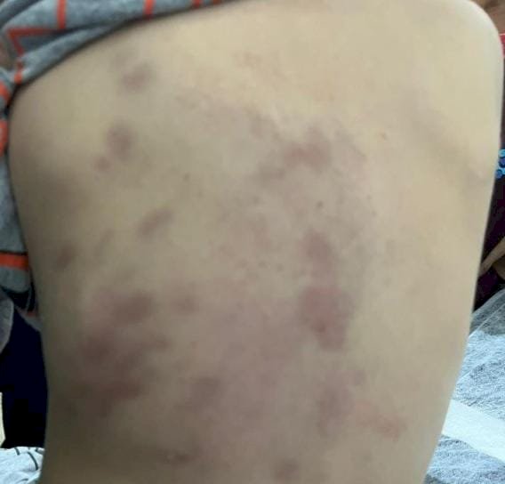 Mãe sai para trabalhar e filho de 3 anos é espancado pelo padrasto; autor está preso