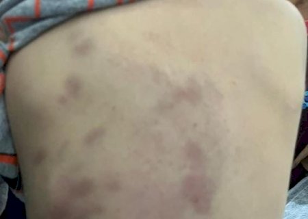 Mãe sai para trabalhar e filho de 3 anos é espancado pelo padrasto; autor está preso