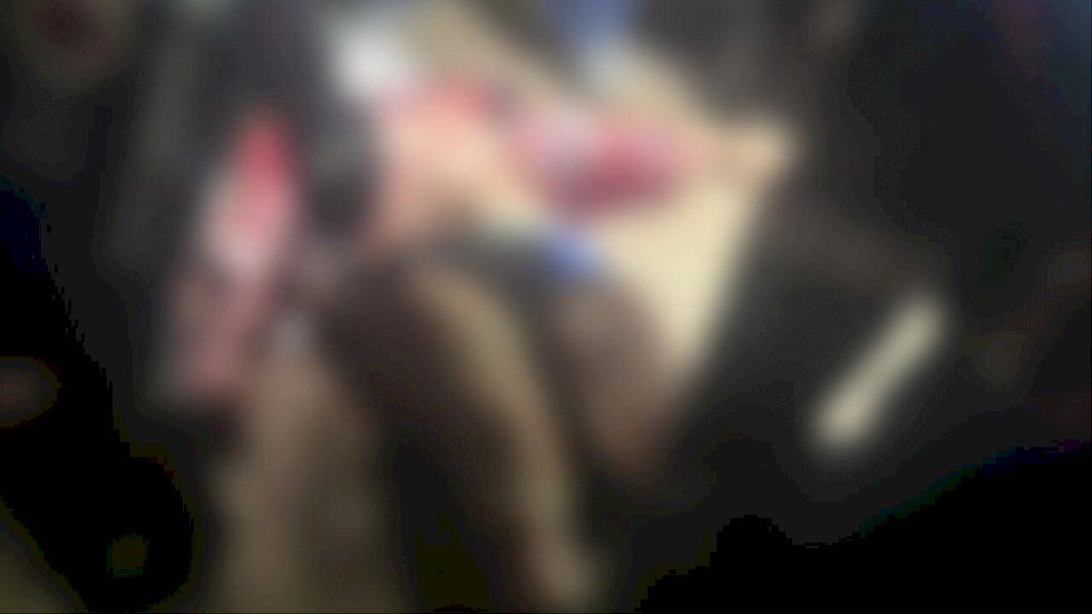 Entregador tem orelha dilacerada e artéria rompida após ataque de pit bulls