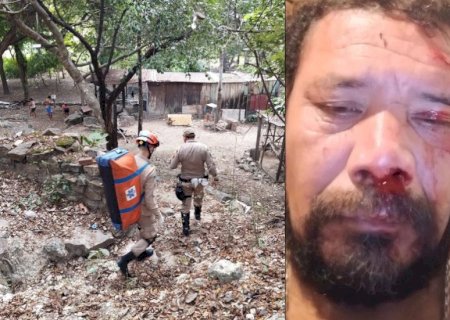 Homem lutou com onça para sobreviver a ataque no Pantanal: 'ela podia arrancar meu rosto'