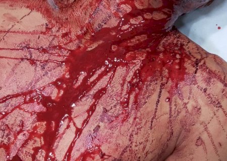 SAMU socorre vítima com ferimentos de arma branca após desentendimento familiar